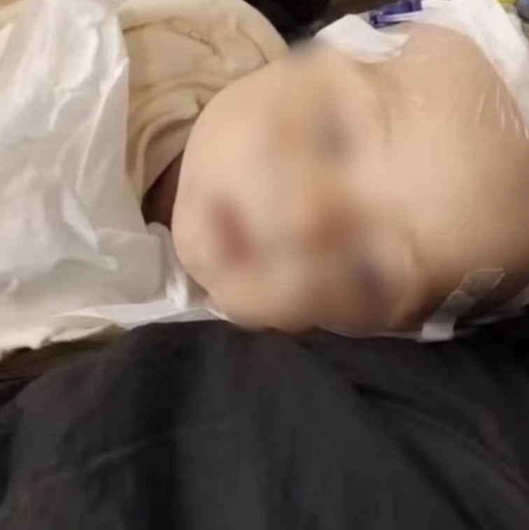 四川6月龄男婴确诊心衰、重症肺炎：治疗缺钱 母亲发起求助(图2)